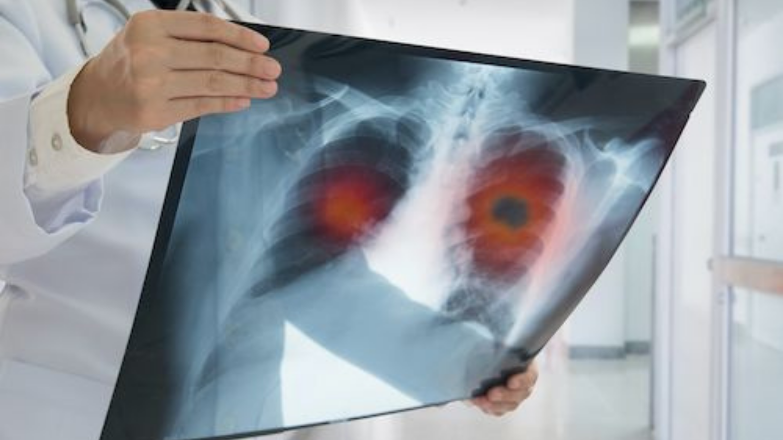UKRI announces £11 million funding for DART lung health project.